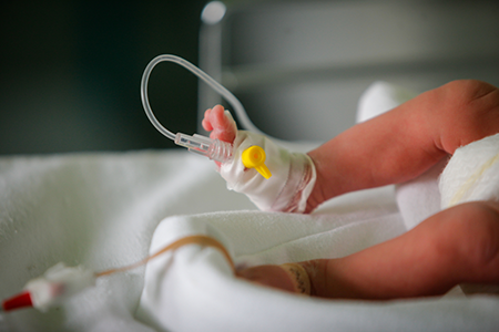 Premature Birth